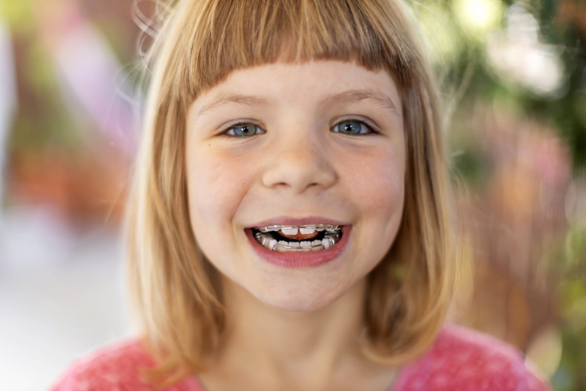 The Benefits of Wearing Braces as a Child Versus an Adult ...