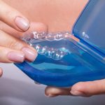 Three Reasons to Avoid Mail-Order Aligners